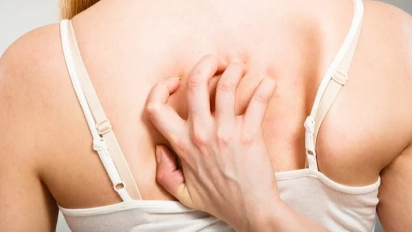 Навици, които предотвратяват появата на акне по тялото