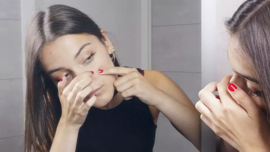 TikTok тренд: Шампоан за пърхот чисти акне