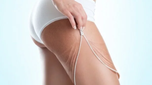 4 упражнения за целулит с бързи резултати (видео)