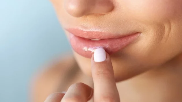 8 неща, които устните издават за здравето ви
