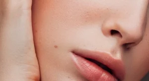 4 натурални начина да се справите с напуканите устни