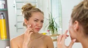 7 начина да излекувате акне без козметика