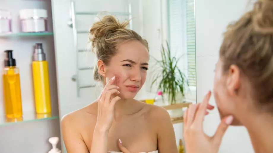 Бюти пробив: Учени разбраха какво предотвратява акнето