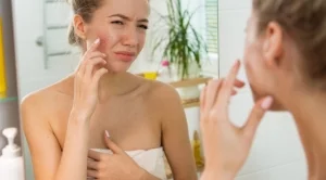 5 съвета за справяне с акнето