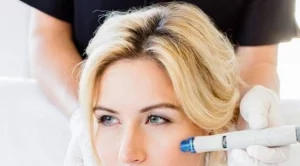 Кожата ти има нужда от почистване с Hydrafacial