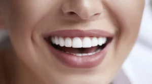 8 натурални начина да избелите зъбите си