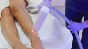 6 неща, които трябва да знаете за лазерната епилация