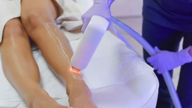 6 неща, които трябва да знаете за лазерната епилация