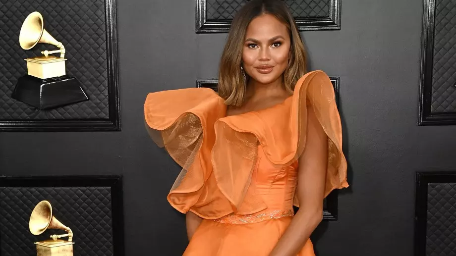 7 звезди, които НЕ се срамуват от пластичните си операции