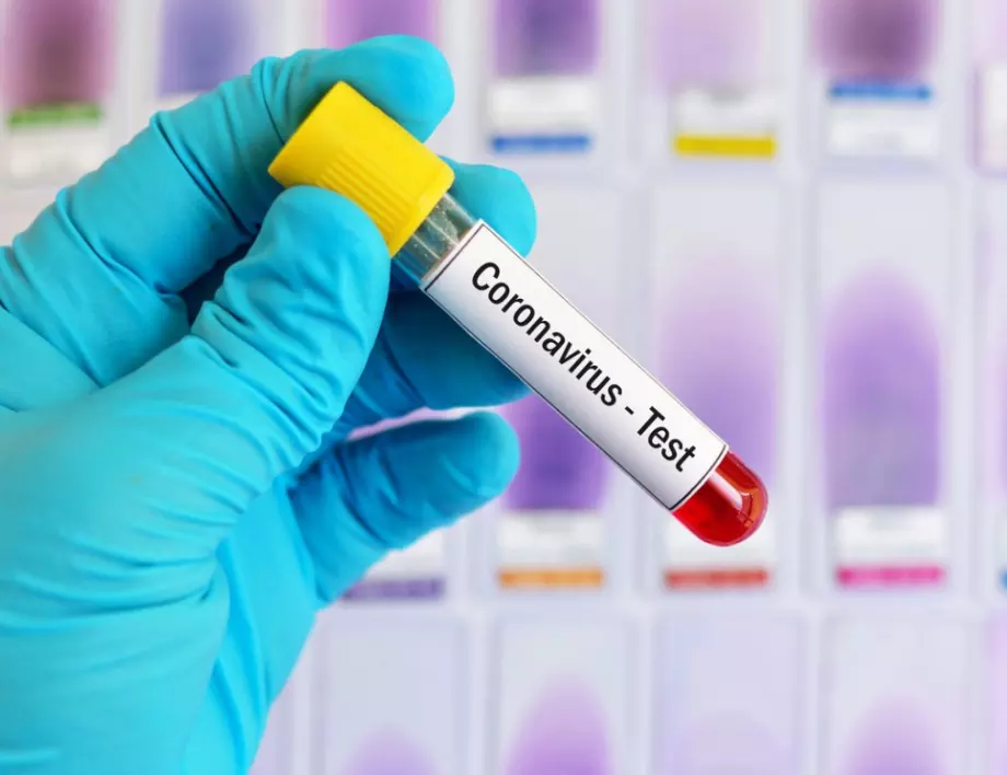 Как да разпознаем коронавируса? (ВИДЕО)