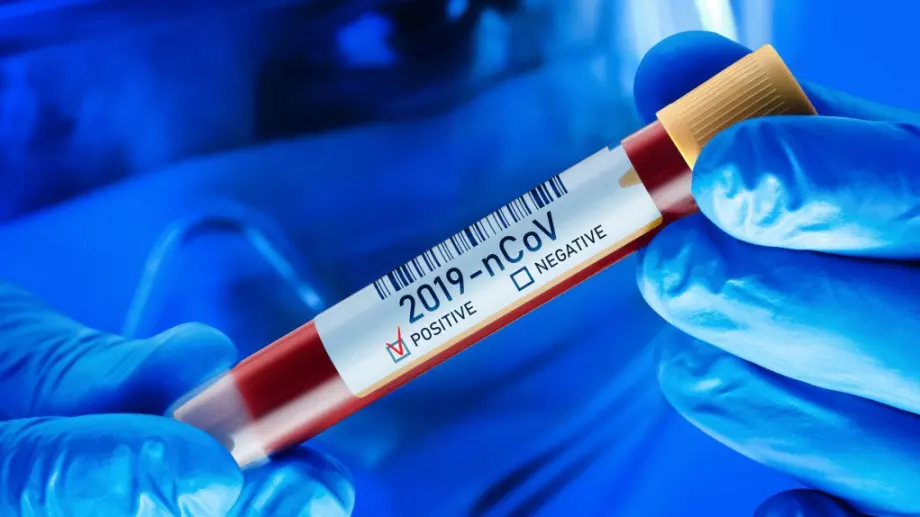 Още 2 жертви на коронавируса, заразените са над 300