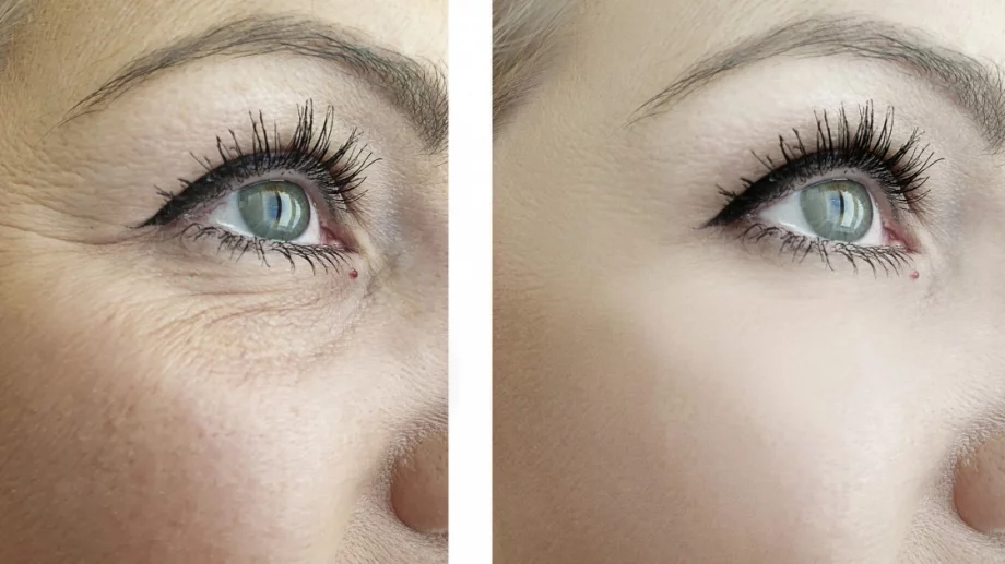 Каква е тайната на бавното остаряване?