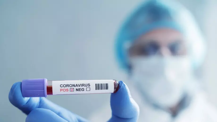 Заразените с коронавирус са почти 400, ръст на тежко болните