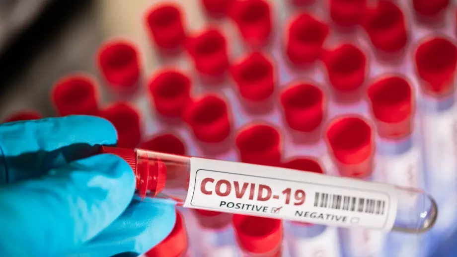 Google проследи как всяка държава спазва изолацията: У нас със 66 % спадат посещенията на ресторанти и с 32 % на паркове