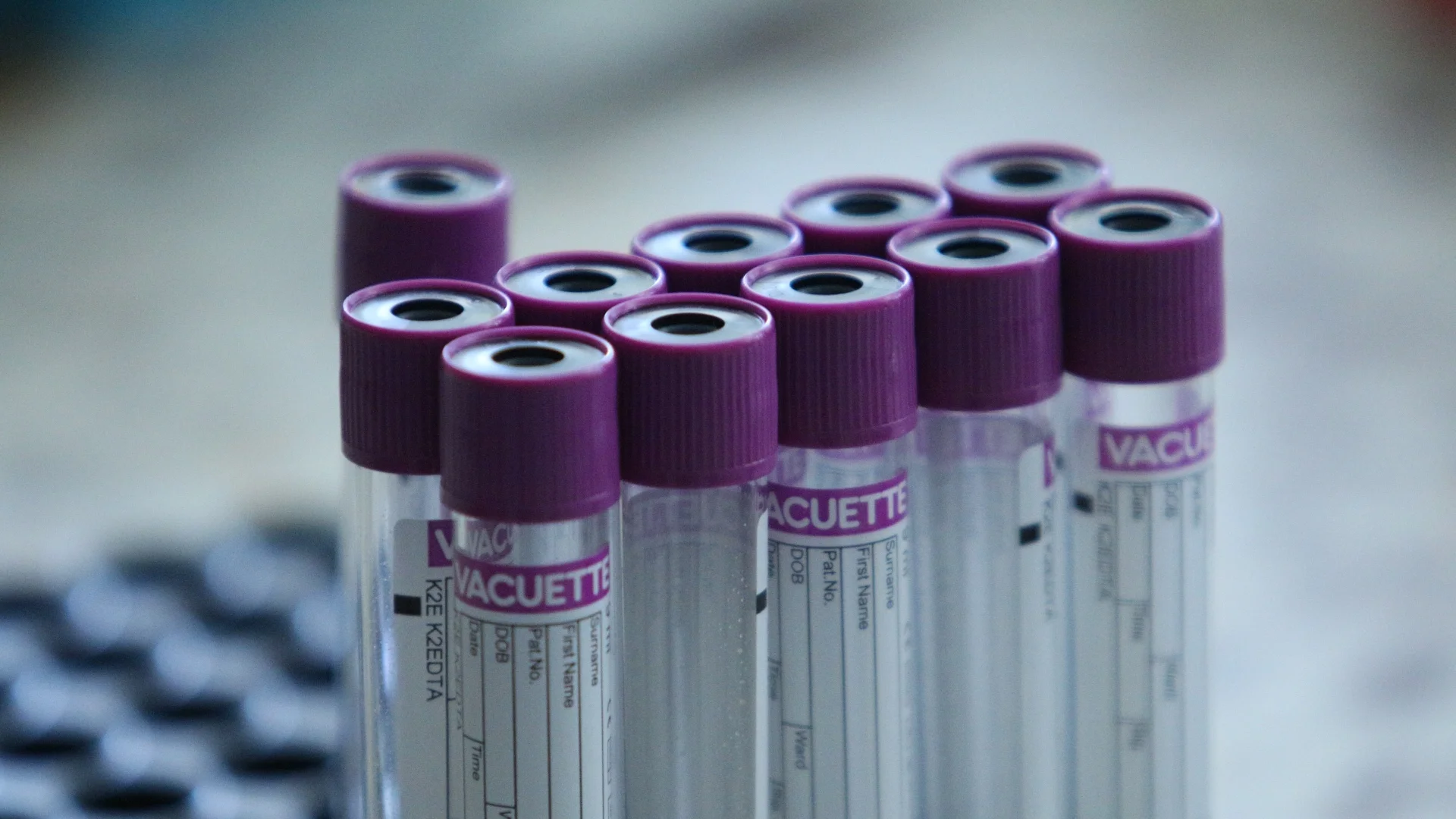 Колко струват тестовете за коклюш?