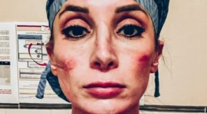 Лицата на медиците, борещи се с коронавируса (СНИМКИ)