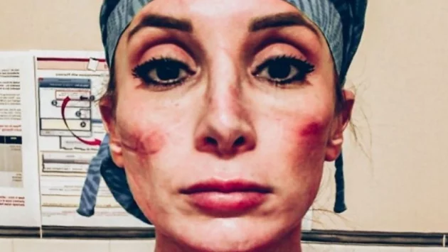 Лицата на медиците, борещи се с коронавируса (СНИМКИ)