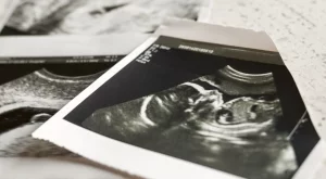 България остава на челно място в ЕС по брой аборти