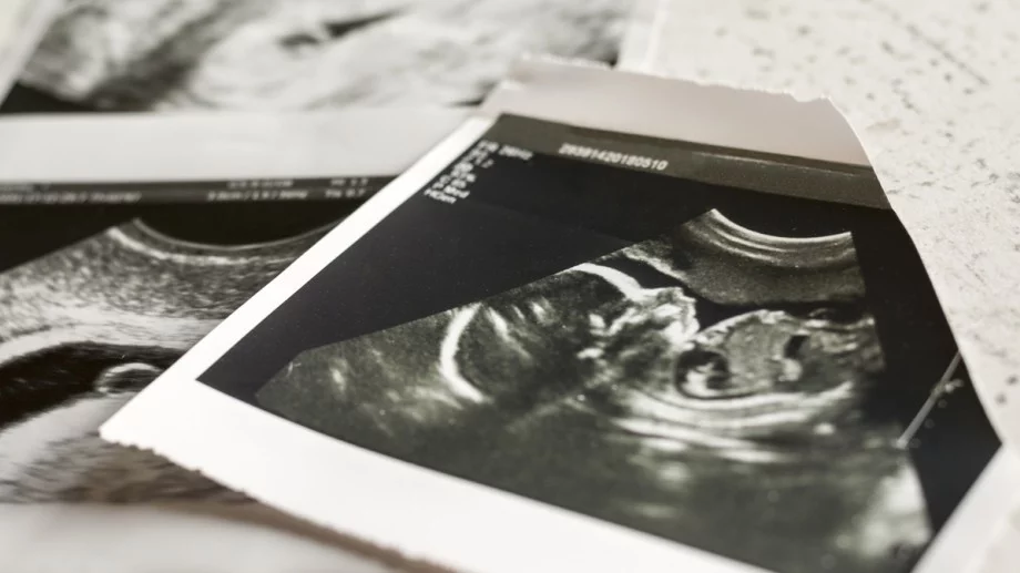 България остава на челно място в ЕС по брой аборти