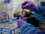 For the first time in six weeks - the cases of coronavirus in Bulgaria have decreased more visibly For the first time in six weeks - the cases of coronavirus in Bulgaria have decreased more visibly