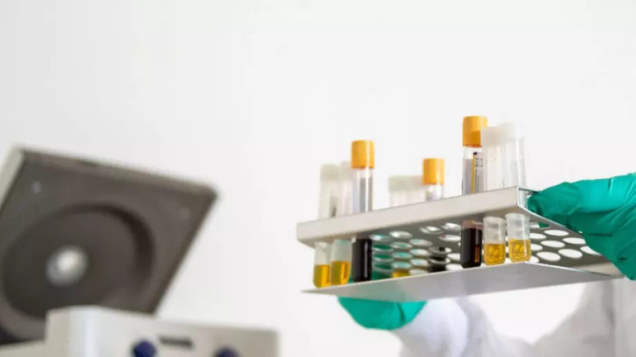 НАП: 1 от 10 лаборатории не издава касови бележки за тестовете за коронавирус