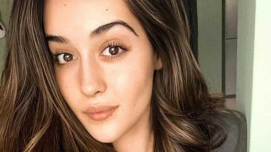 Дъщерята на Гала се съблече и си показа стриите (СНИМКА)