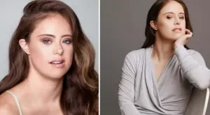 Модел с Даун доказва, че щастието и успеха са в наши ръце