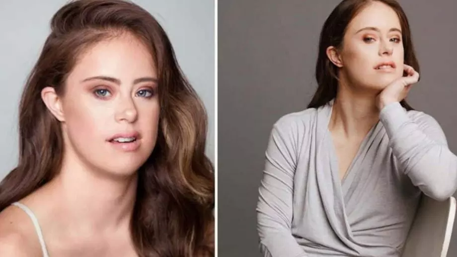 Модел с Даун доказва, че щастието и успеха са в наши ръце