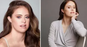 5 модела със Синдром на Даун, които пробиха в суровия свят на модата