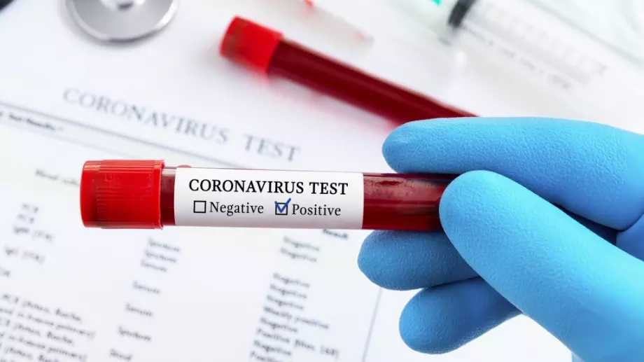 Два пъти по-малко заразени и още 2 жертви на COVID-19