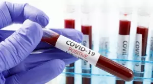 Голям ръст на болните и починалите от COVID-19