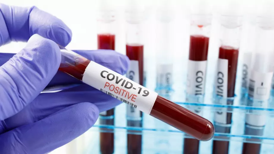 Нов тест показва имунитета срещу Covid-19