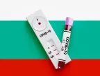 Процентът на положителните тестове за коронавирус нараства, но все още не значително Процентът на положителните тестове за коронавирус нараства, но все още не значително