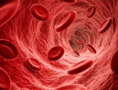 Лекар каза най-честата причина за тромбоза и блокиране на кръвоносните съдове