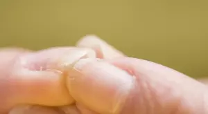 Алкохолът вреди и на ноктите