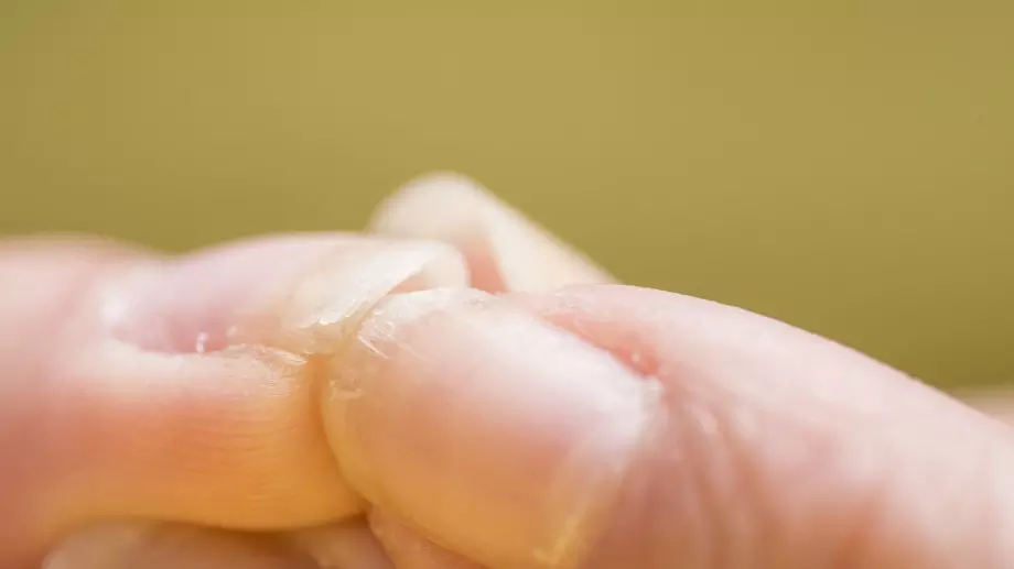 Алкохолът вреди и на ноктите