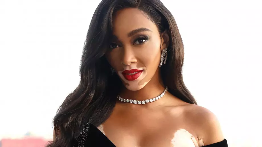 Хора, изумяващи с нестандартната си красота