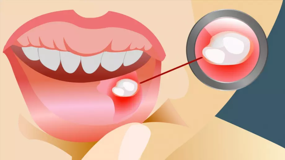 Ако имате поне един от тези симптоми, бягайте при доктор