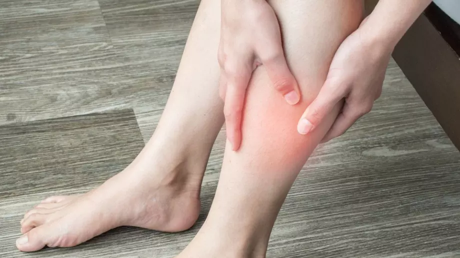 Симптоми, че имате тромбоза 