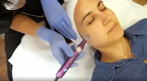 Тествахме микронидлинг с корейска козметика (ВИДЕО)