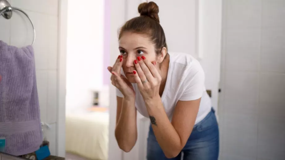 Ето как да се отървем от тъмните кръгове под очите