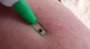 Стъпка по стъпка: Как се вади кърлеж