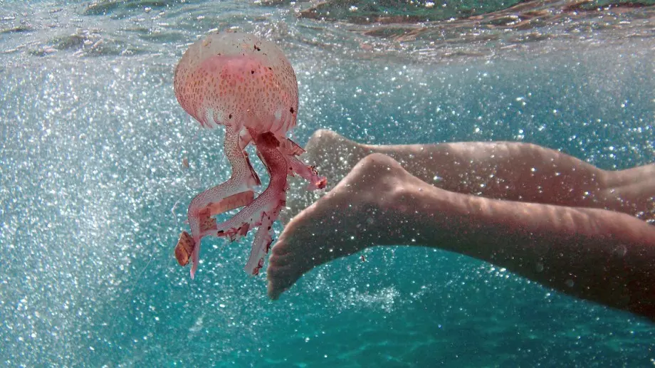 Какво да направите при опарване от медуза  