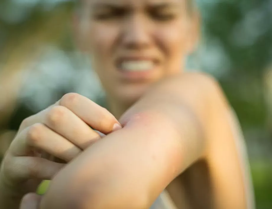Ако сте алергични към ухапване от насекоми, спазвайте златни правила