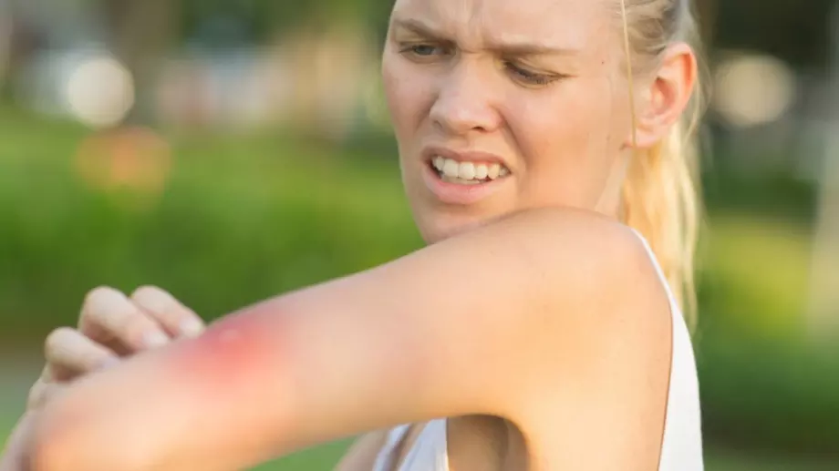 7 научни причини да сте магнит за комарите