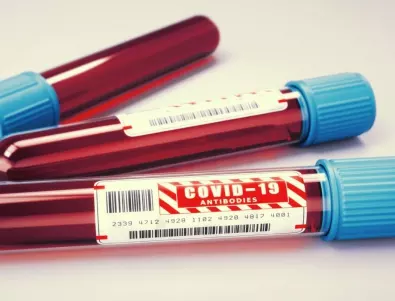 Експерт: Тестовете за антитела могат да се фалшифицират лесно