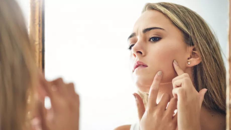 Уникална маска против акне у дома