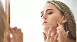 5 популярни добавки, които понякога водят то акне