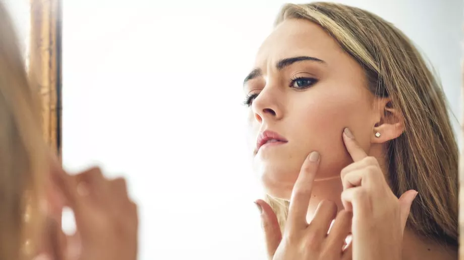 5 популярни добавки, които понякога водят то акне