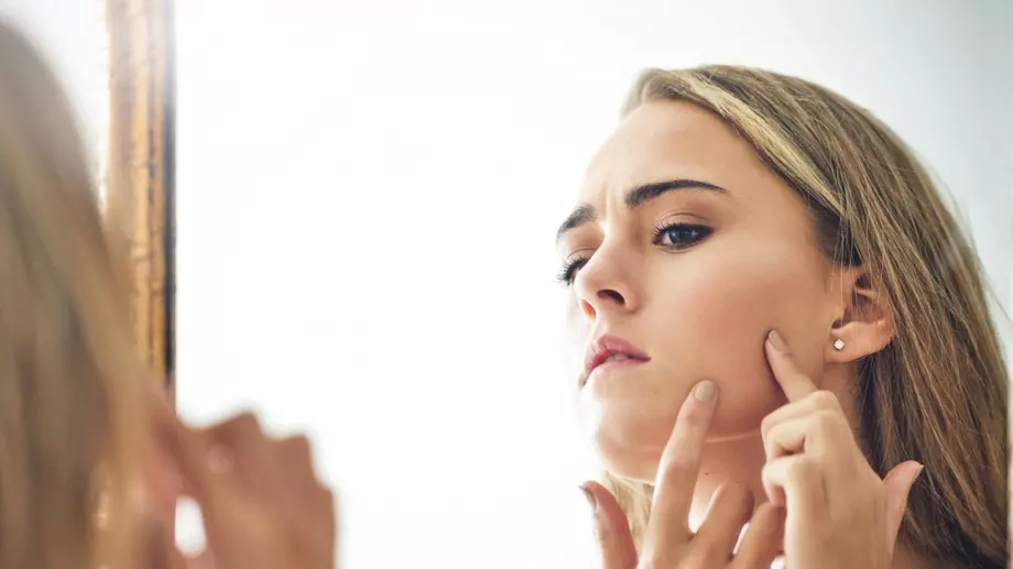 Ето какви са причините за акне по различните части на тялото